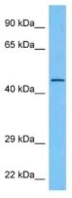 Connexin 46/GJA3 Rabbit anti-Mouse, Polyclonal, Novus Biologicals 100 &mu;g | Buy Online | Novus Biologicals | Fisher Scientific